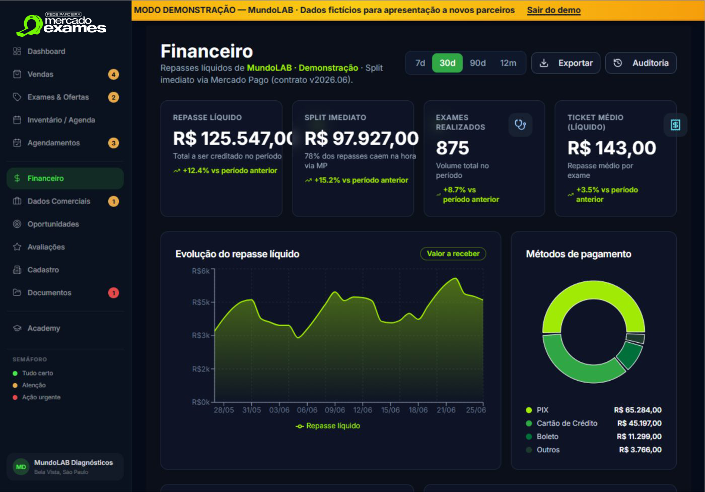 Financeiro — repasse líquido, split imediato e métodos de pagamento